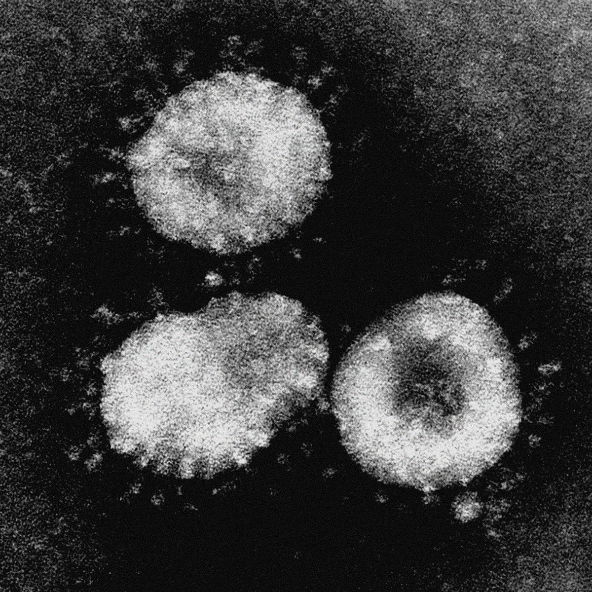 DREIECK INTERFERENCES Demain